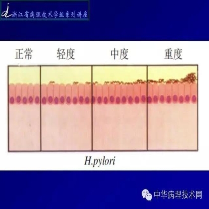 特殊染色 - HP染色