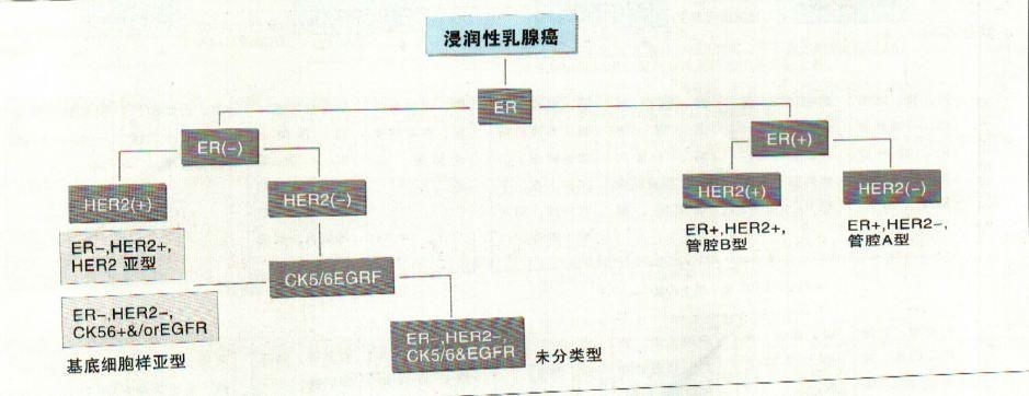 浸润性乳腺癌免疫组化分型