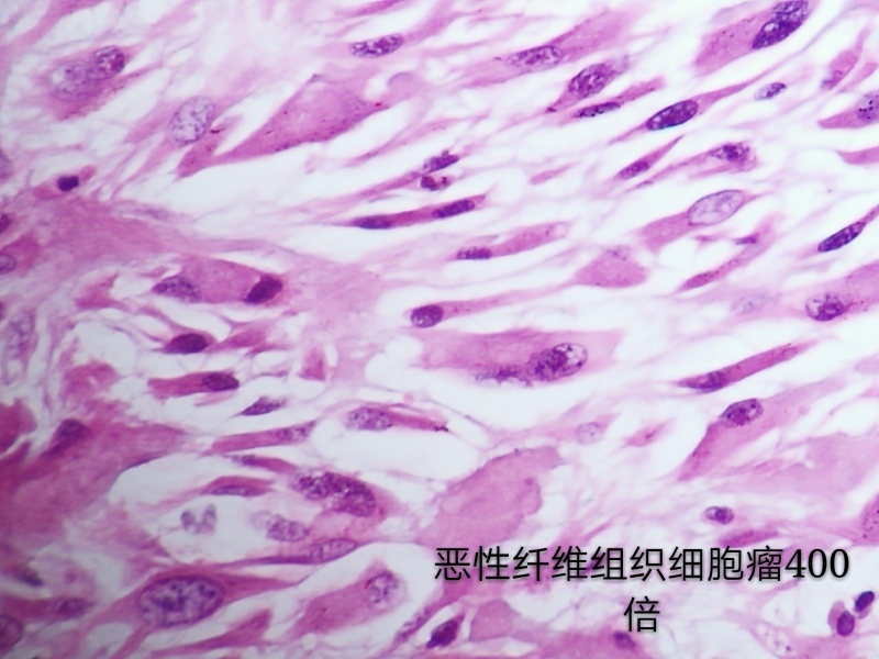 病理科工作札记（三十六）如何用手机拍出满意的组织学照片