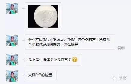 前列腺腺癌？（芳分享病例，华夏泌尿群讨论，孔祥田老师讲解）