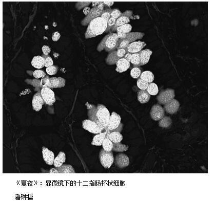 显微镜下的病理之美