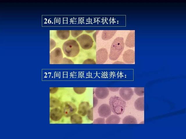 收藏！寄生虫图谱大全