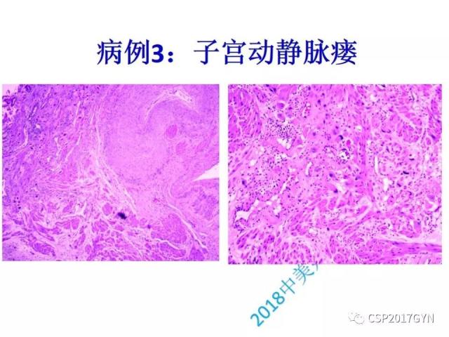 病理临床结合 开拓诊断视野