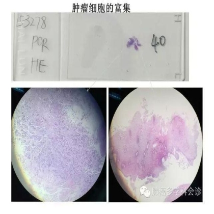 EGFR基因突变检测--基础篇