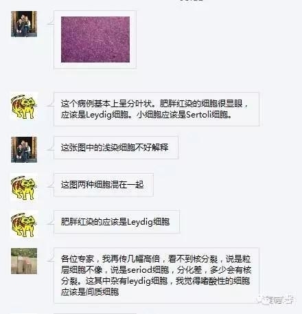 低分化支持－间质细胞瘤（ 戴敏病例分享，群友讨论，刘从容老师讲解）