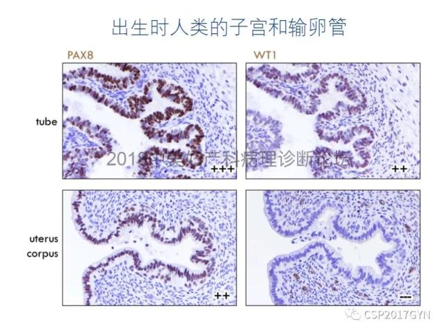 女性生殖道发育