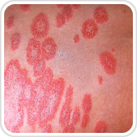 Webpathology.com-镜像翻译（自学使用，版权归原网站所有）