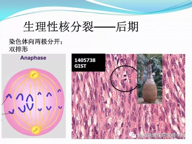 病理学基础知识 : 核分裂像的识别