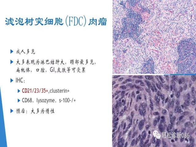 组织细胞来源疾病