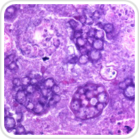 Webpathology.com-镜像翻译（自学使用，版权归原网站所有）