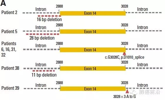 【JCO】MET exon14缺失突变可能为肺肉瘤样癌的潜在作用靶点