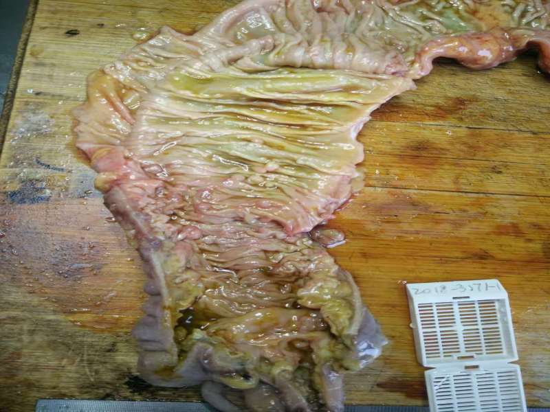 病理科工作札记（二十五）家族性大肠腺瘤病