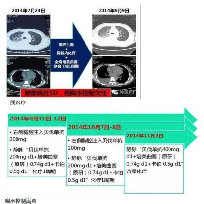 中日韩个体化诊疗案例大赛经典赏析之十——驱动基因双突变，两种靶向药物均无效，个体化治疗的阿克琉斯之踵