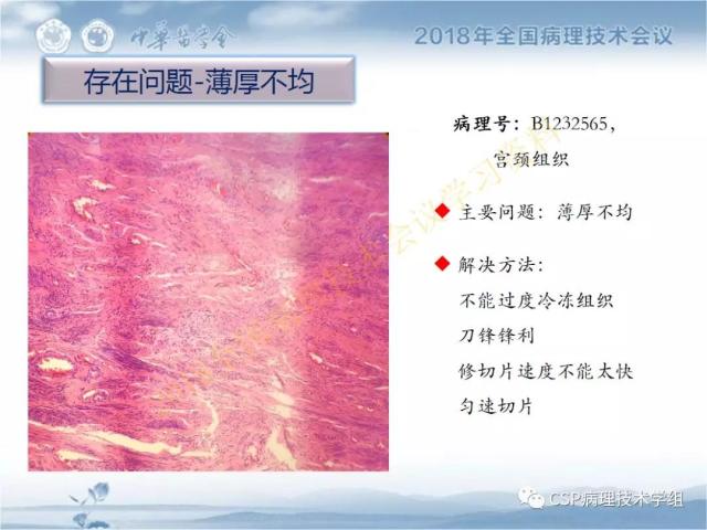 宋欣：HE切片质量控制及常见问题分析