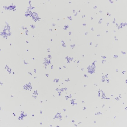 【文献解读】利用CRISPR/Cas9编辑技术构建MLH1新型免疫组化质控品
