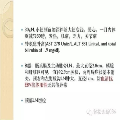 滤泡性淋巴瘤