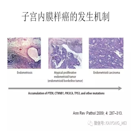 卵巢癌的病理诊断新进展（二）