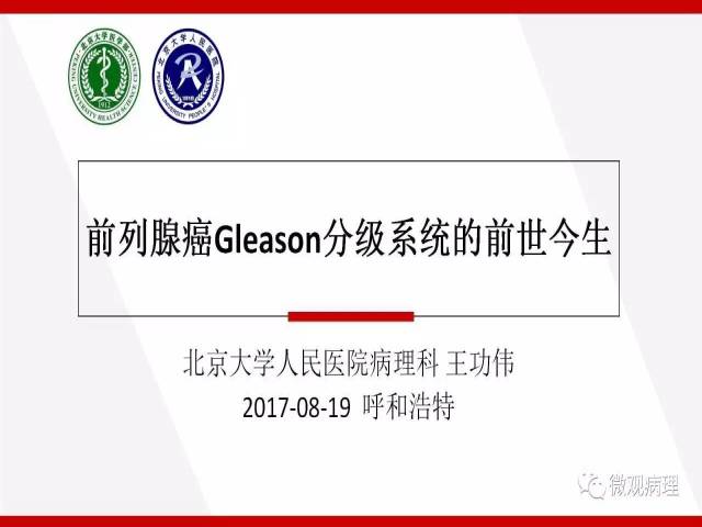 前列腺癌Gleason分级系统的前世今生