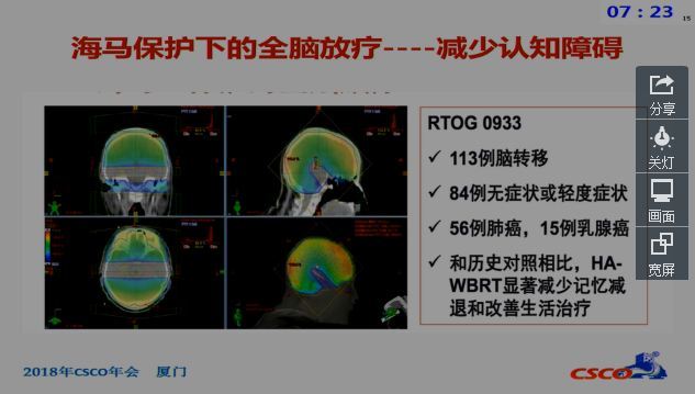 2018 CSCO 乳腺癌脑转移诊疗指南解读