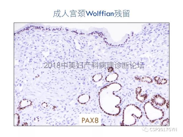 女性生殖道发育