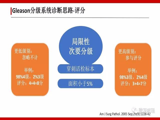 前列腺癌Gleason分级系统的前世今生