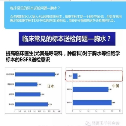 EGFR基因突变检测--基础篇