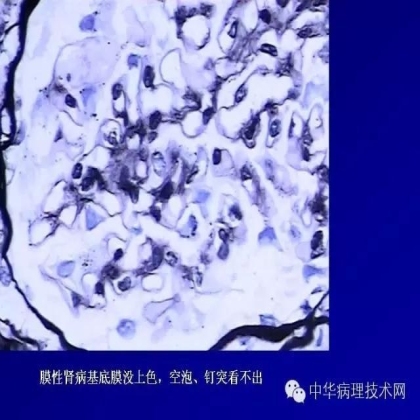 肾穿活检组织特殊染色方法