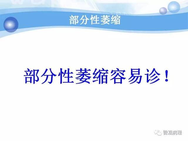 泌尿课程/局灶性前列腺萎缩