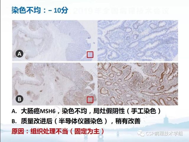 免疫组化检测的临床应用与质量评估