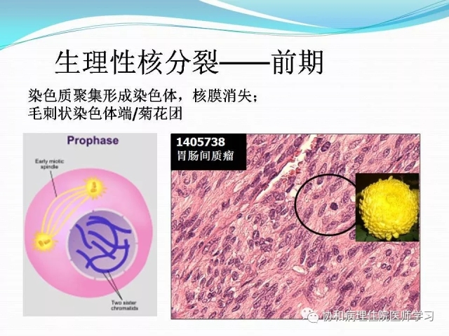 病理学基础知识 : 核分裂像的识别