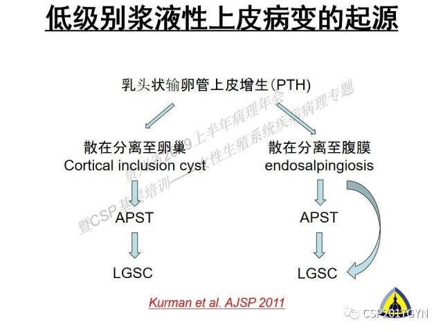 中华病理学会基层培训遵义站讲座（一）——卵巢和输卵管浆液性肿瘤的诊断和鉴别诊断
