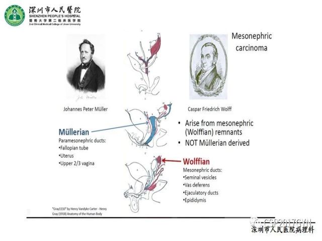 2019USCAP妇科病理热点介绍