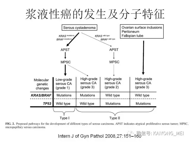 卵巢癌的病理诊断新进展（一）