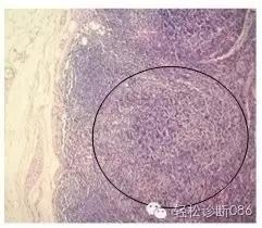 淋巴结T区和髓质组织学