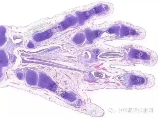 介绍几种日常工作中常见组织的脱钙方法