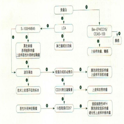 恶性上皮样细胞肿瘤免疫组化标记物诊断示意图