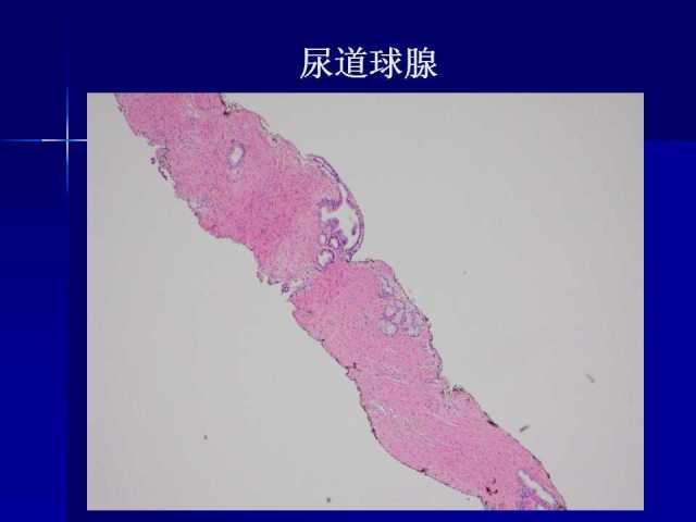 前列腺病理诊断线索（上）——黄教悌