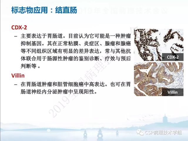 免疫组化检测的临床应用与质量评估