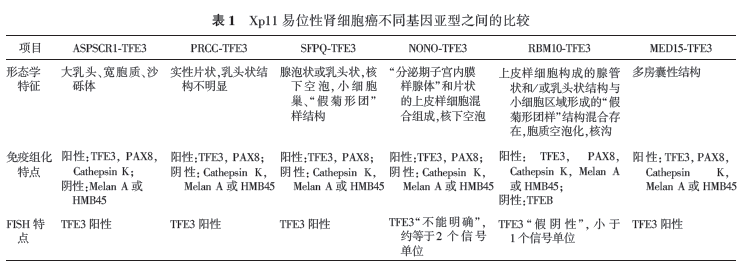 浅谈儿童肾脏肿瘤的病理诊断