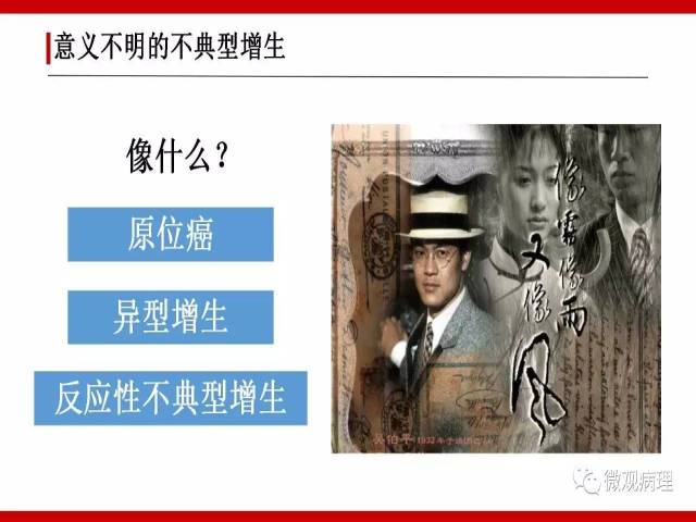 泌尿课程/非浸润性尿路上皮病变诊断的一些困惑