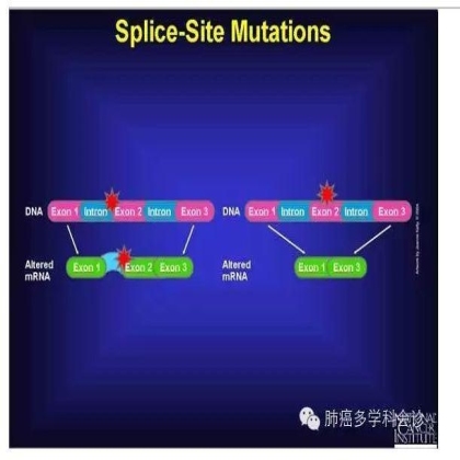 MET抑制剂治疗肺腺癌开疆拓土：MET 14外显子跳跃突变