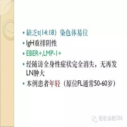 滤泡性淋巴瘤