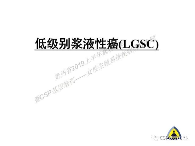 中华病理学会基层培训遵义站讲座（一）——卵巢和输卵管浆液性肿瘤的诊断和鉴别诊断