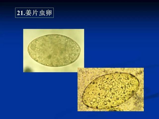 收藏！寄生虫图谱大全
