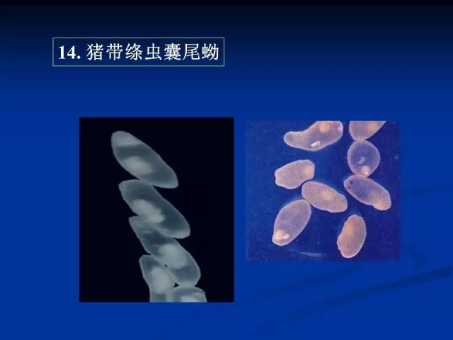 收藏！寄生虫图谱大全