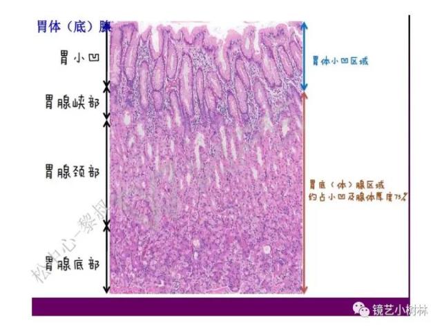 上消化道早癌病理的学习心得体会（附胃牵手癌的病例特点文献学习）