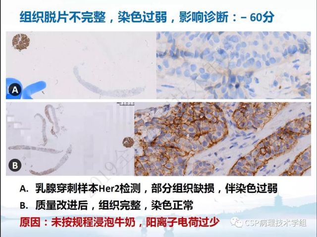 免疫组化检测的临床应用与质量评估