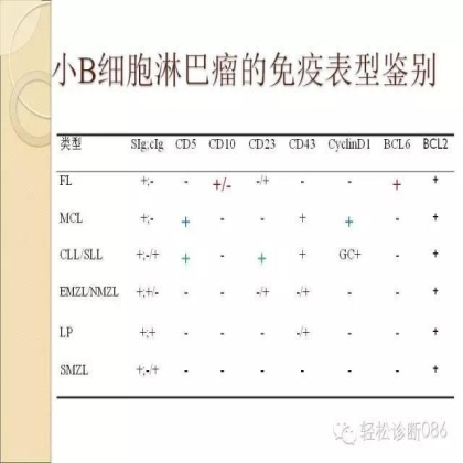 滤泡性淋巴瘤