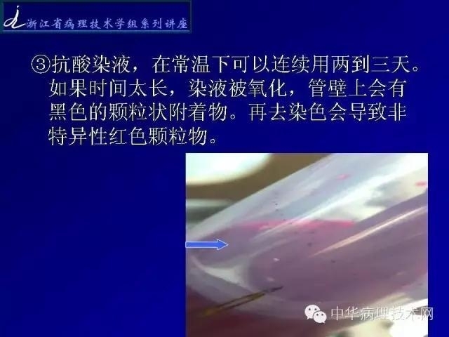 特殊染色-抗酸染色
