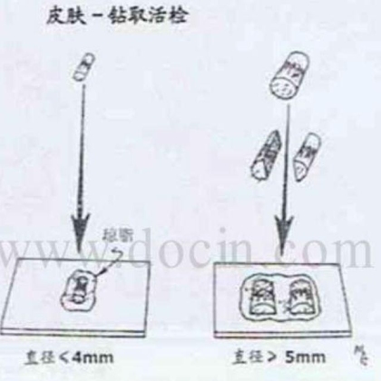 病理标本取材规范